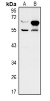 Rabbit anti-ZNF446 Polyclonal Antibody