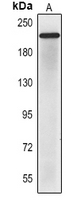 Mouse anti-CD56 Monoclonal Antibody
