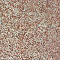 Mouse anti-β-Catenin Monoclonal Antibody