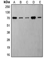 Rabbit anti-Phospho-S6K1(Thr421) Polyclonal Antibody