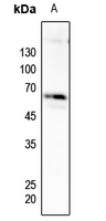 Rabbit anti-Phospho-PFKFB2(Ser483) Polyclonal Antibody