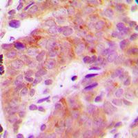 Rabbit anti-Phospho-S6K1(Thr421) Polyclonal Antibody