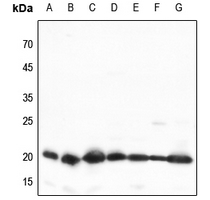 Rabbit anti-TOM20 Polyclonal Antibody