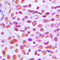 Rabbit anti-NF-kappaB p65 Polyclonal Antibody