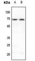 Rabbit anti-PIAS3 Polyclonal Antibody