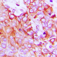 Rabbit anti-HER4 Polyclonal Antibody