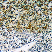 Rabbit anti-Phospho-p47 Phox(Ser345) Polyclonal Antibody
