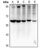 Rabbit anti-MT-ND5 Polyclonal Antibody