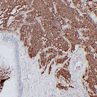 Mouse anti-CD56 Monoclonal Antibody