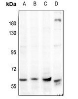 Rabbit anti-AMPK α1/2 Polyclonal Antibody