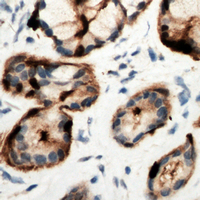 Rabbit anti-Adenosine A2b Receptor Polyclonal Antibody