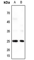 Rabbit anti-Neuromedin U Polyclonal Antibody