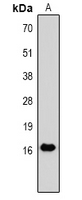 Mouse anti-TNF-α Monoclonal Antibody