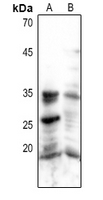Rabbit anti-Caspase 3 Polyclonal Antibody