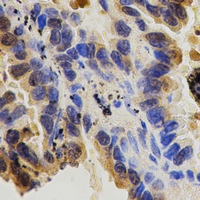 Rabbit anti-CD29 Polyclonal Antibody