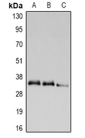 Rabbit anti-UCP2 Polyclonal Antibody