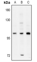 Rabbit anti-ELP2 Polyclonal Antibody