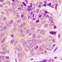 Rabbit anti-PEA15 Polyclonal Antibody