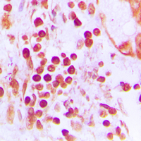 Rabbit anti-CstF-50 Polyclonal Antibody