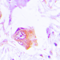 Rabbit anti-p47 Phox Polyclonal Antibody