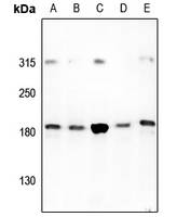 Rabbit anti-HER2 Polyclonal Antibody
