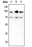 Rabbit anti-TGFBR2 Polyclonal Antibody
