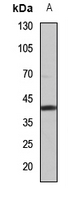 Rabbit anti-ZNT2 Polyclonal Antibody