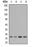 Rabbit anti-HSD17B13 Polyclonal Antibody