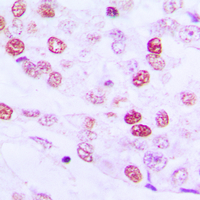 Rabbit anti-Cyclin E1 Polyclonal Antibody