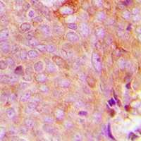 Rabbit anti-MRPS9 Polyclonal Antibody