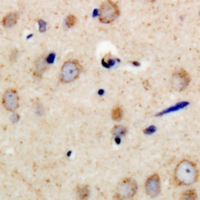 Rabbit anti-PSMD11 Polyclonal Antibody