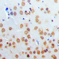 Rabbit anti-PARP3 Polyclonal Antibody
