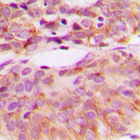 Rabbit anti-Phospho-c-SRC(Tyr529) Polyclonal Antibody