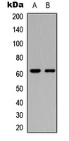 Rabbit anti-CERKL Polyclonal Antibody