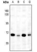 Rabbit anti-NF-kappaB p65 Polyclonal Antibody