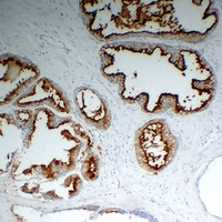 Mouse anti-PSMA Monoclonal Antibody
