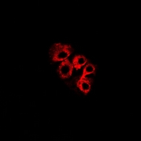 Rabbit anti-C4BP β Polyclonal Antibody