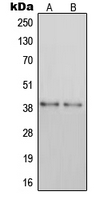 Rabbit anti-GPR105 Polyclonal Antibody