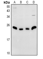 Rabbit anti-N4WBP5 Polyclonal Antibody
