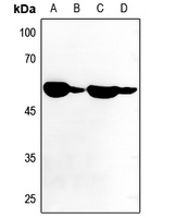 Rabbit anti-ATP6V1B1 Polyclonal Antibody