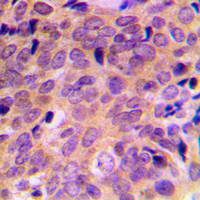 Rabbit anti-ATF4 Polyclonal Antibody
