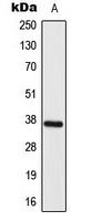 Rabbit anti-ELOVL4 Polyclonal Antibody
