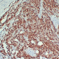 Mouse anti-CD63 Monoclonal Antibody