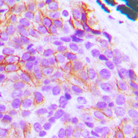 Rabbit anti-BIM Polyclonal Antibody