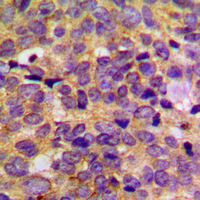 Rabbit anti-PRKAR2B Polyclonal Antibody