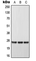 Rabbit anti-DHRS2 Polyclonal Antibody