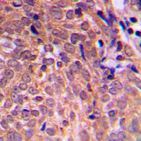 Rabbit anti-APC Polyclonal Antibody