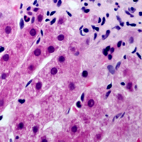Rabbit anti-Cytochrome P450 21A2 Polyclonal Antibody