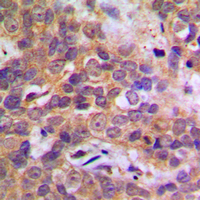 Rabbit anti-p38 Polyclonal Antibody