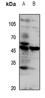 Rabbit anti-GPR172A Polyclonal Antibody